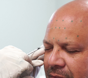 Botox-vs.-Fillers-Whats-the-Difference-and-Which-One-Do-You-Need-dermatologist-laplace-botox-and-fillers-laplace
