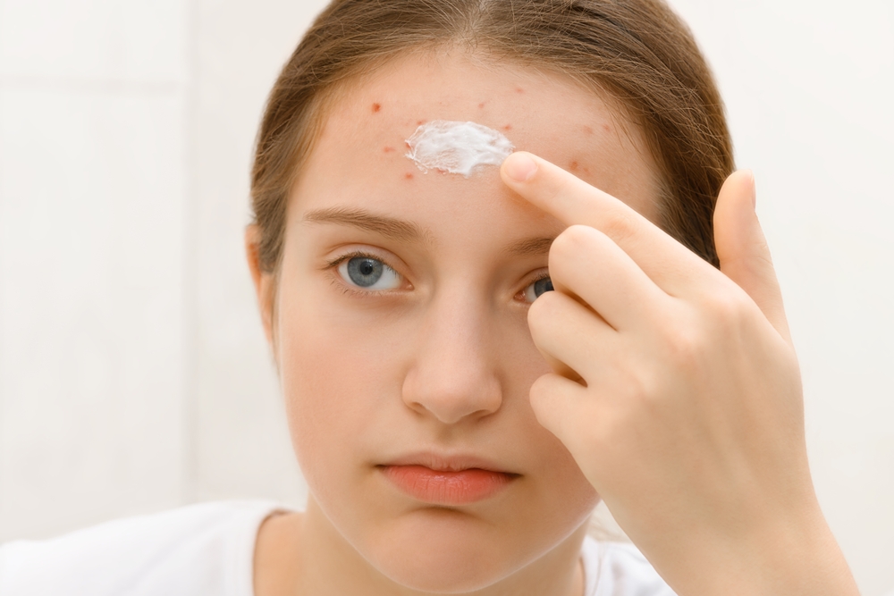 acne local care - acne treatment in laplace - laplace dermatology clinic