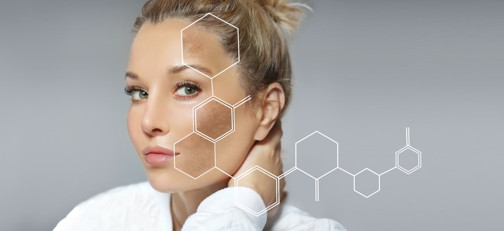 why patients come to us for melasma care - laplace dermatologist