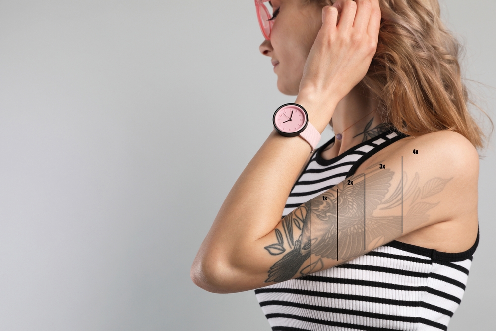 tattoo removal in laplace - laplace dermatology-