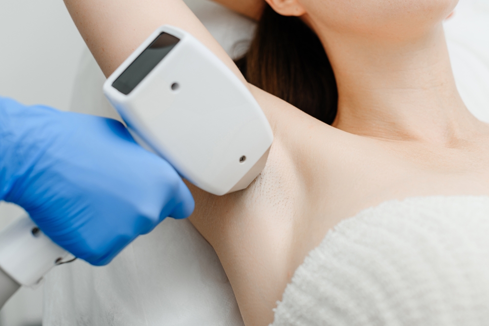 woman removing armpit hair with laser - laplace dermatology
