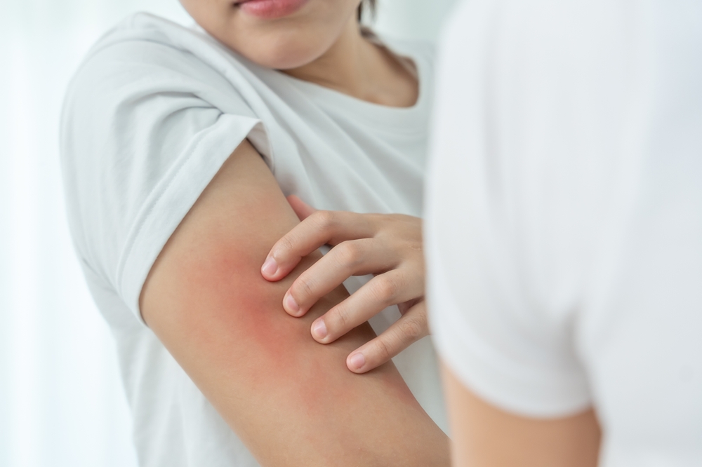 skin allergy treatment in laplace - laplace dermatologist