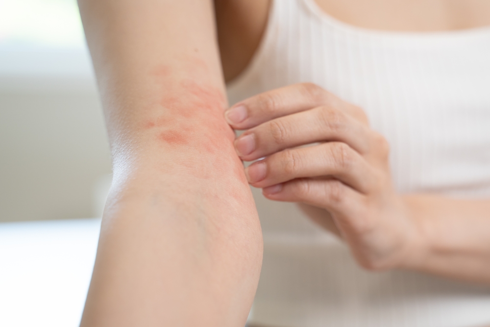 Can Fall Allergies Make Your Skin Itchy - dermatologist in laplace